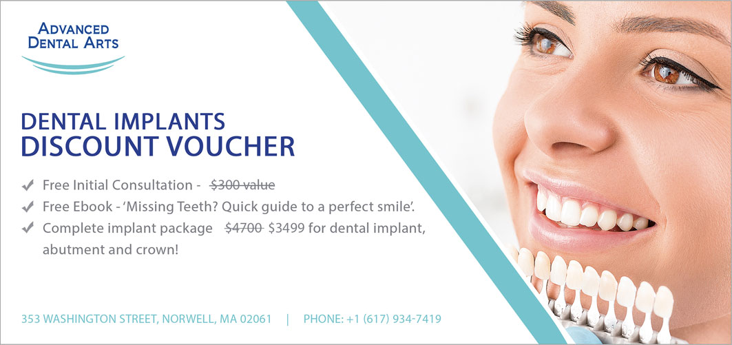 Dental Implant Discount Voucher