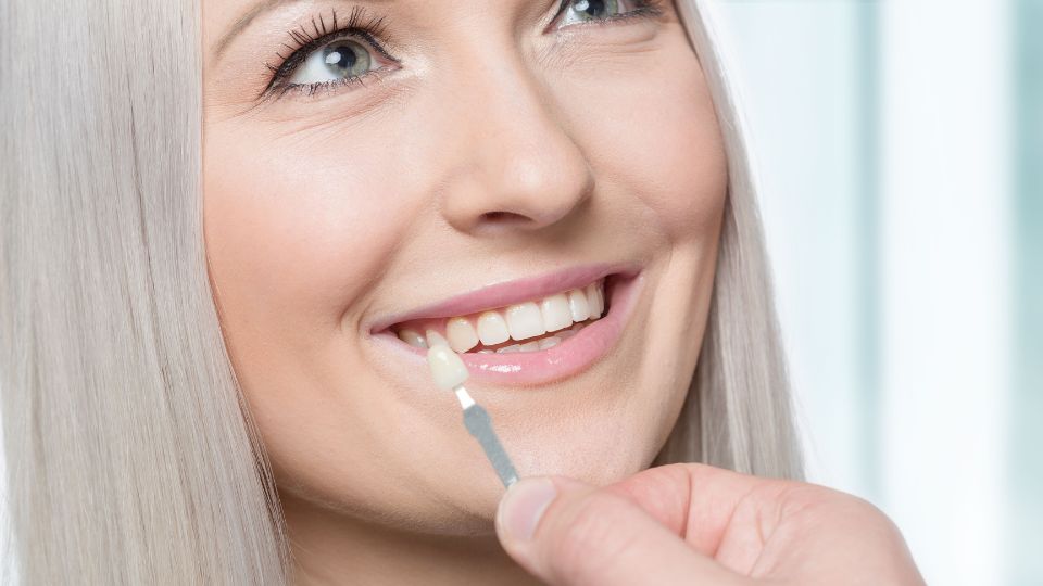 How to Choose Veneers That Suit Your Face
